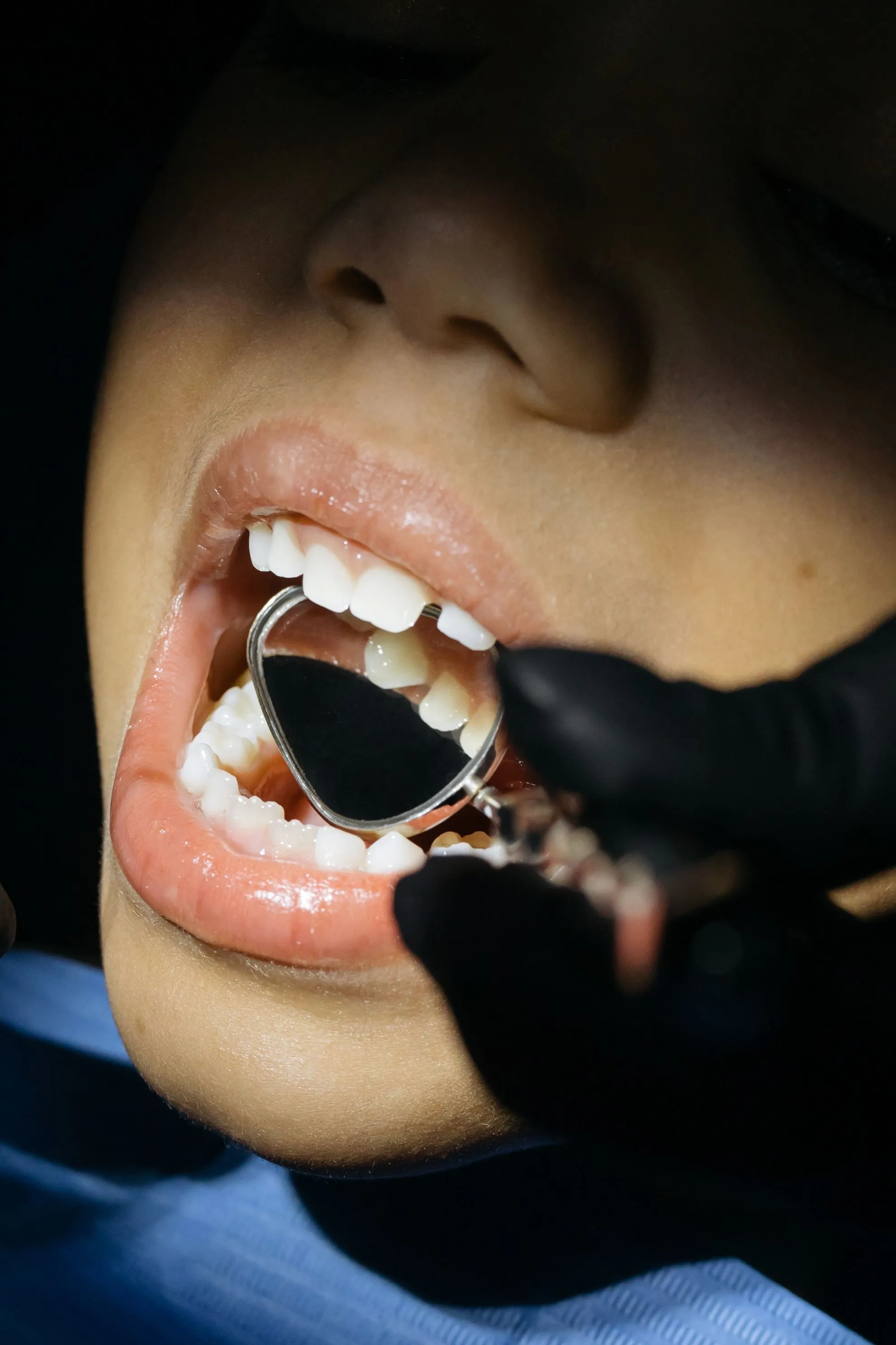 Pediatric dental care